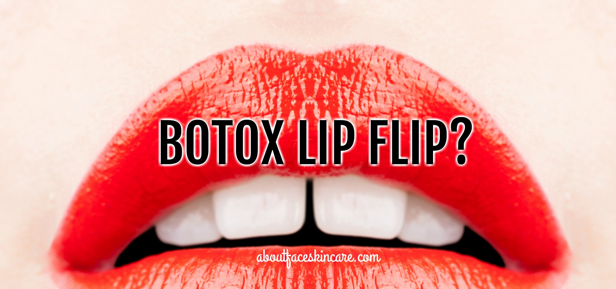 Botox Lip Flip May Be Latest Trend In Injectables But About Face Aesthetics 8421