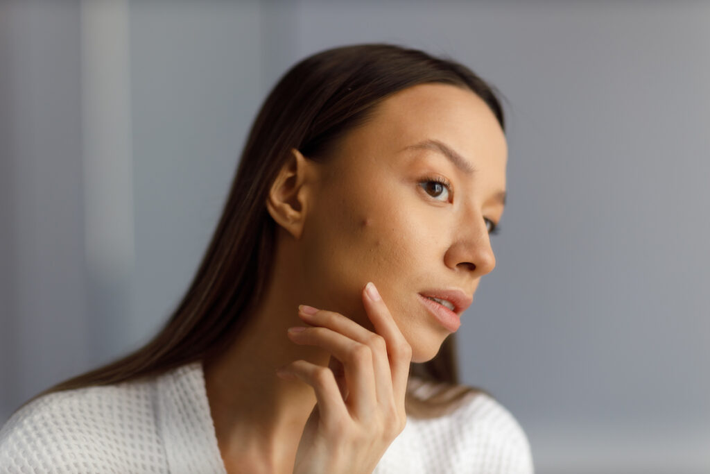 A woman examines her face, of aware of our [Treatments for] forehead acne scars in Philadelphia