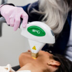 A woman gets an IPL treatment in Philadelphia at About Face Aesthetics