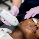A client gets a Clear + Brilliant laser treatments in Philadelphia at About Face Aesthetics