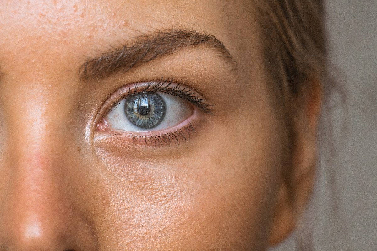 Under Eye Filler Philadelphia | About Face Aesthetics