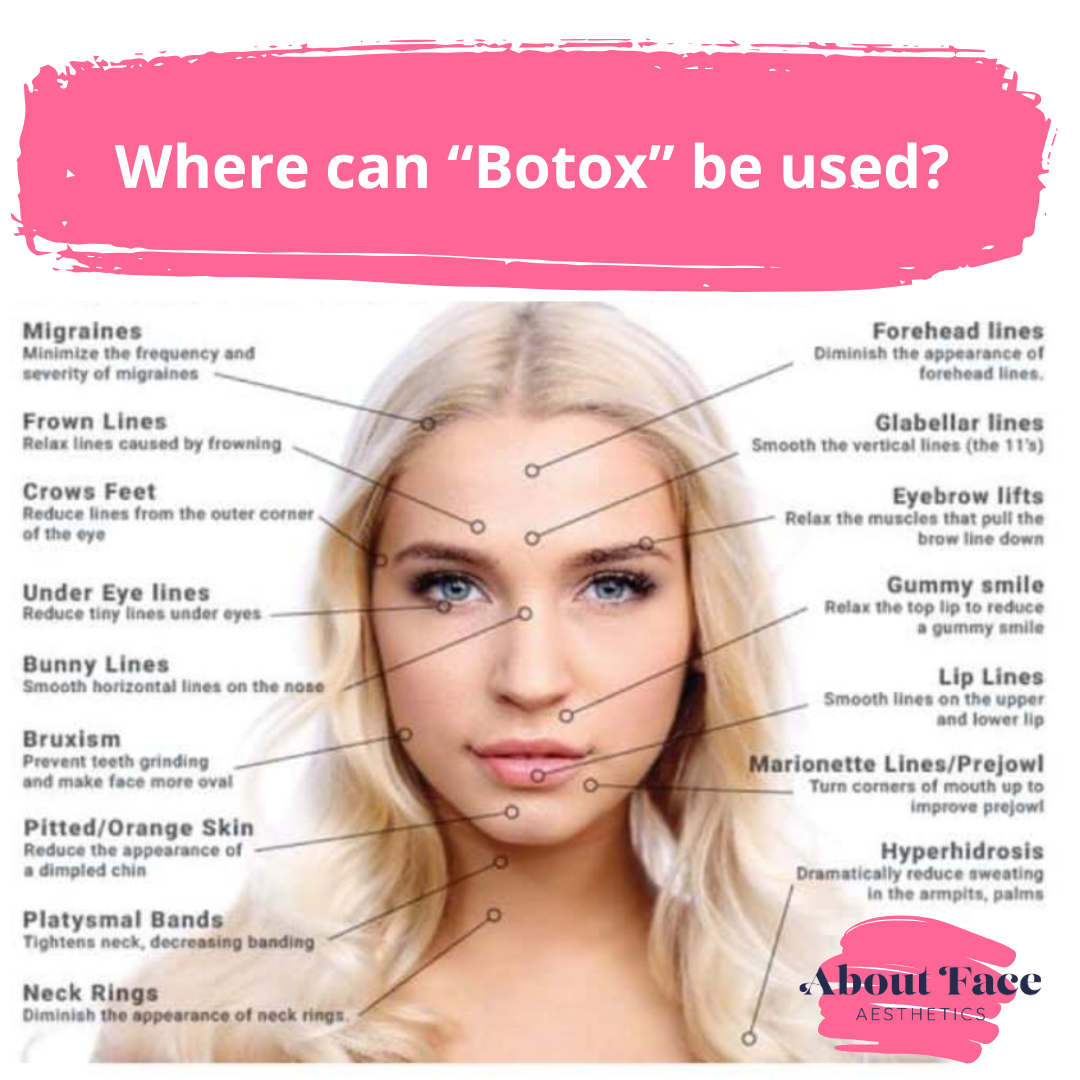 Top 10 Most Popular Botox Facial Injection Sites