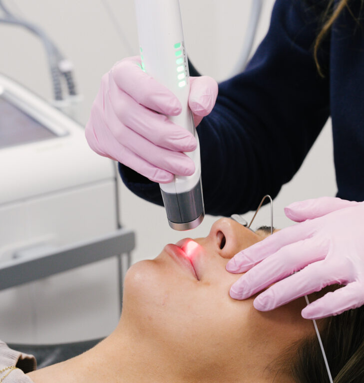 philadelphia lip laser