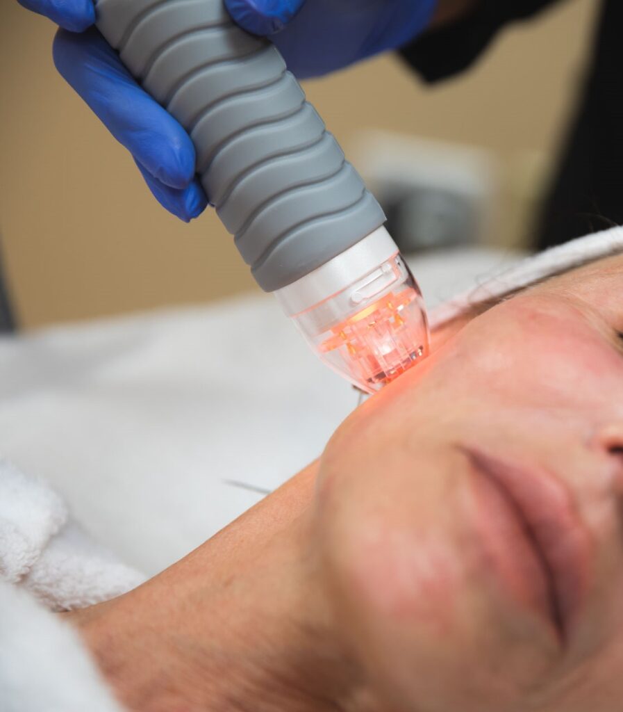 Laser treatment consultation in Philadelphia at About Face Aesthetics